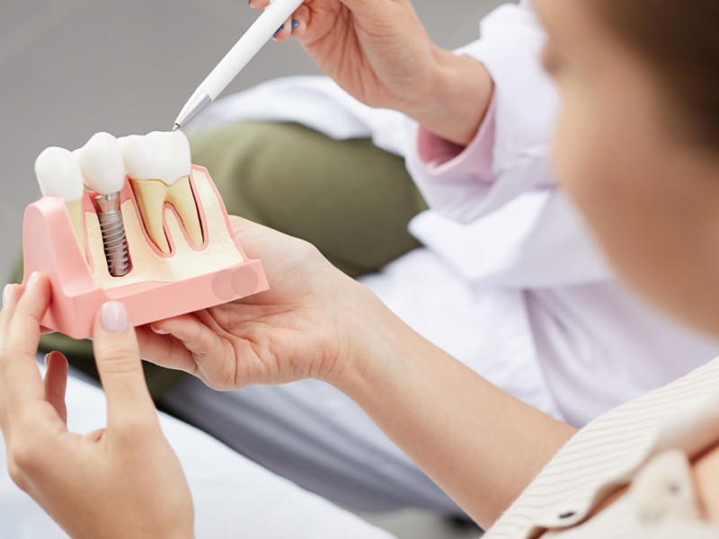 Colocar implantes dentários dói? Saiba mais